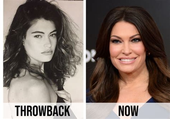 Kim Guilfoyle's Transformation: A Visual Chronicle Of Before And After