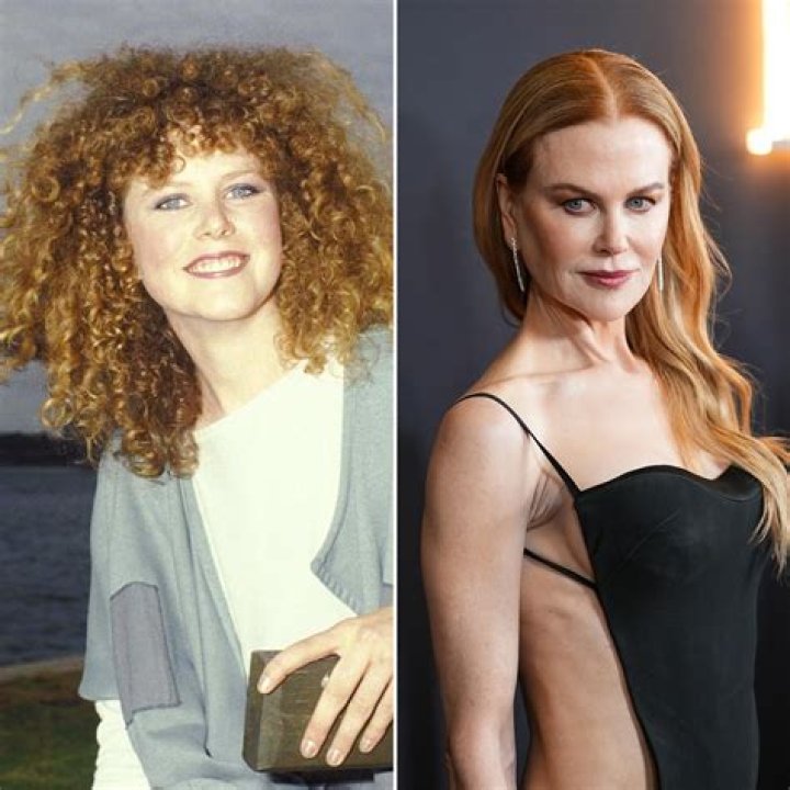 Nicole Kidman's Dramatic Transformation: Before And After Facelift