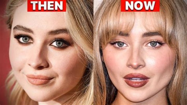 Sabrina Carpenter Cosmetic Surgery: The Truth Revealed