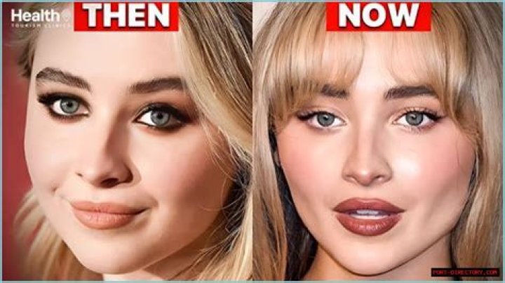Sabrina Carpenter Plastic Surgery: A Complete Breakdown Of Her Procedures