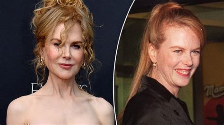 The Truth About Nicole Kidman's Fillers: A Comprehensive Guide