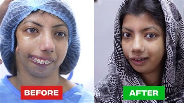Tommie Before Surgery: A Journey Of Transformation