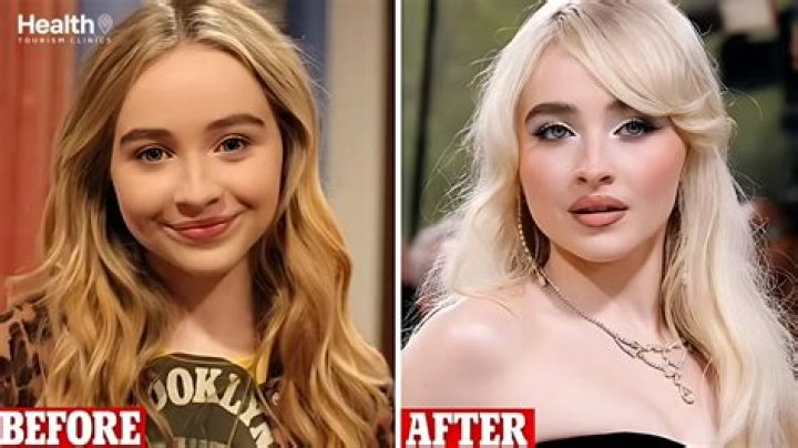 Top Secrets Of Sabrina Carpenter's Plastic Surgery Transformation