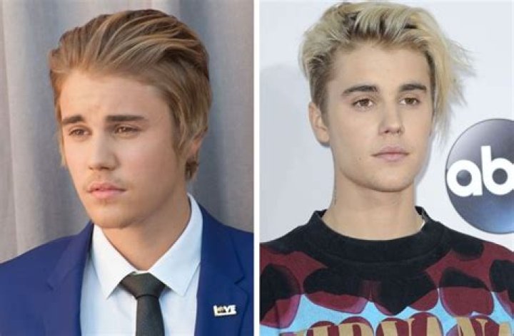 [Ultimate Guide] Justin Bieber's Hairline Secrets Revealed