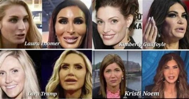 Unveiling The Transformation: Kimberly Guifoyle And Her Journey Through Plastic Surgery